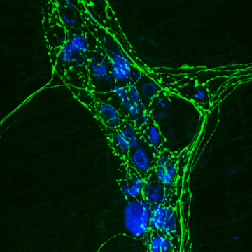 From wikipedia, Tyrosine hydroxylase labeled in neurons