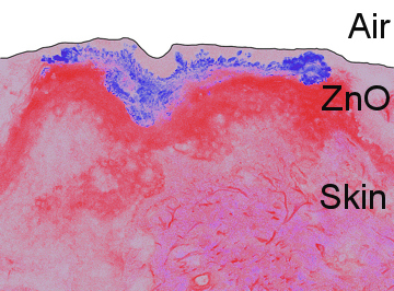 Confocal false colour image of Zinc Oxide nano-particles on human skin